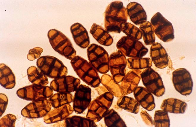 Image of Pithomyces chartarum spores